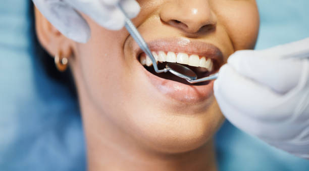 Best Emergency Root Canal Treatment in Palm Desert, CA