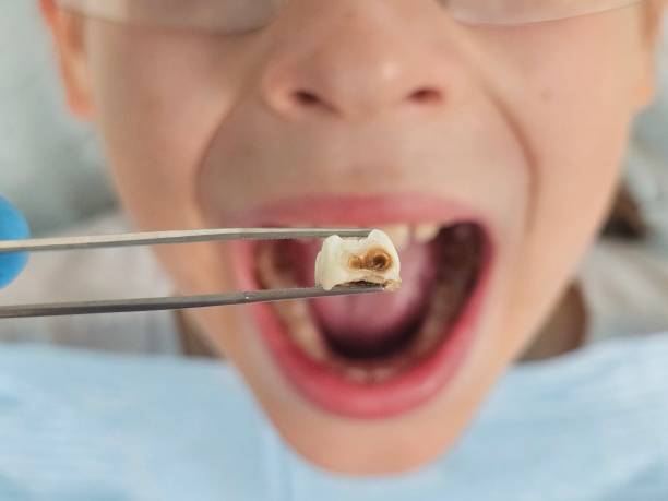 Best Pediatric Emergency Dentist in Palm Desert, CA